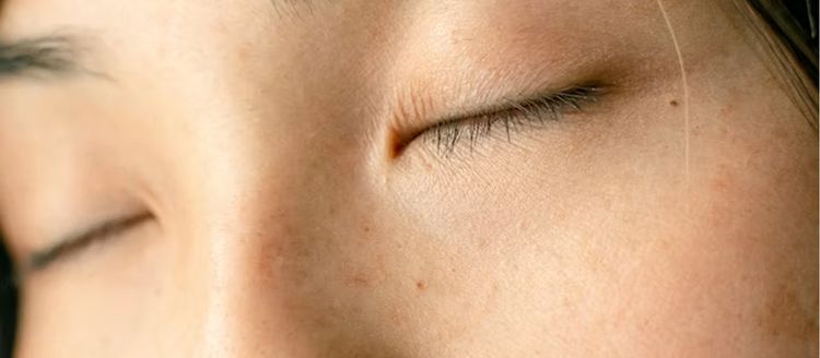Linge de lit et allergies : quelle matière choisir quand on a la peau sensible ?