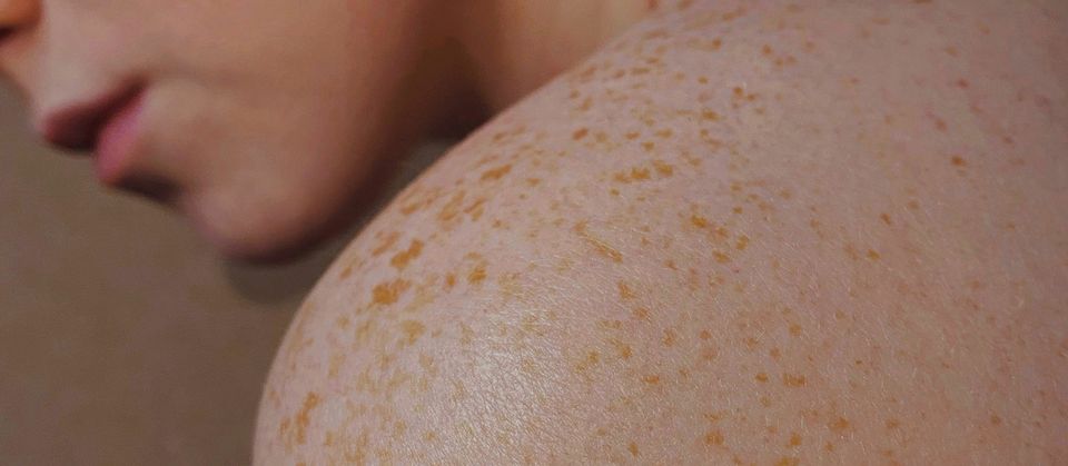 Matelas en latex naturel et allergies : la vérité sur les acariens